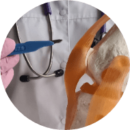 FEMORAL_OSTEOPLASTY_img